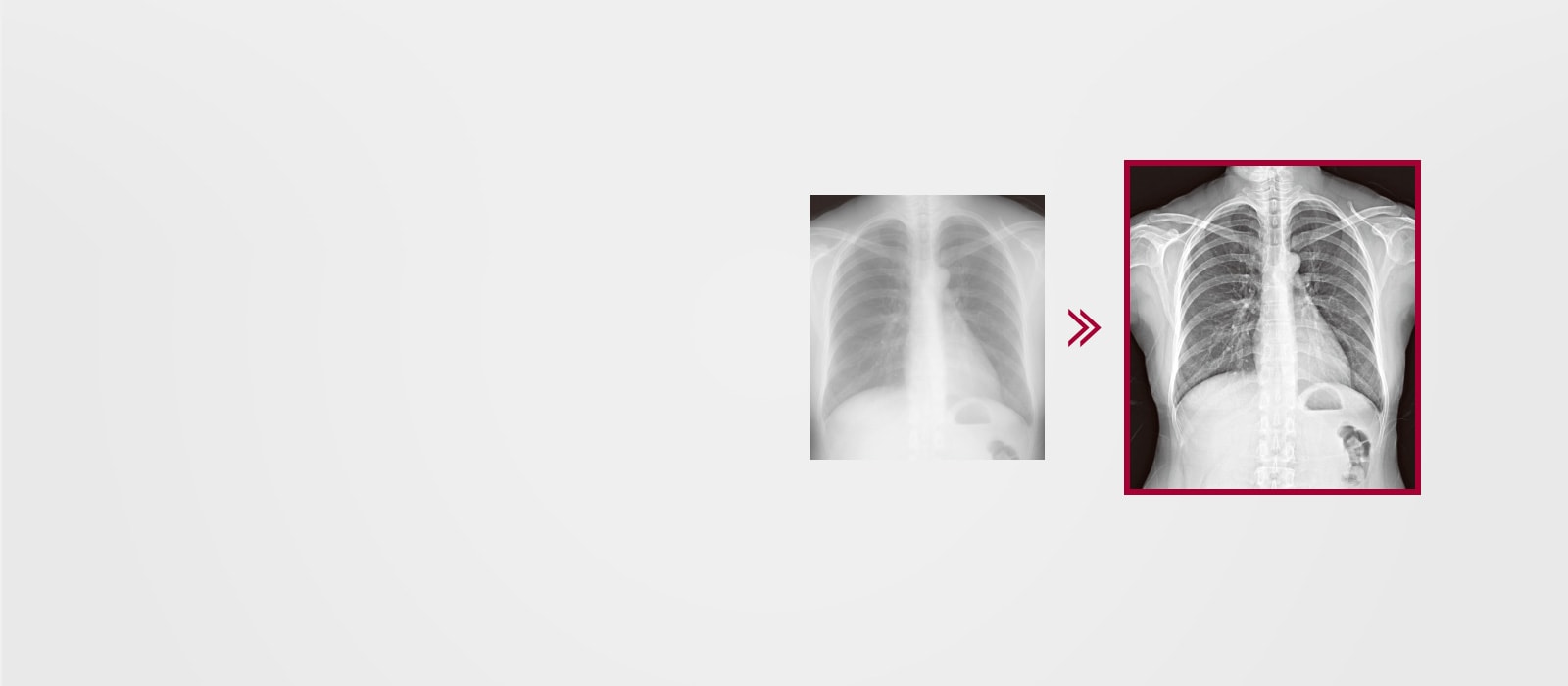 The more finely detailed image result using Multi-layer Image Processing embedded in the AWS, comparing to the image result without Multi-layer Image Processing