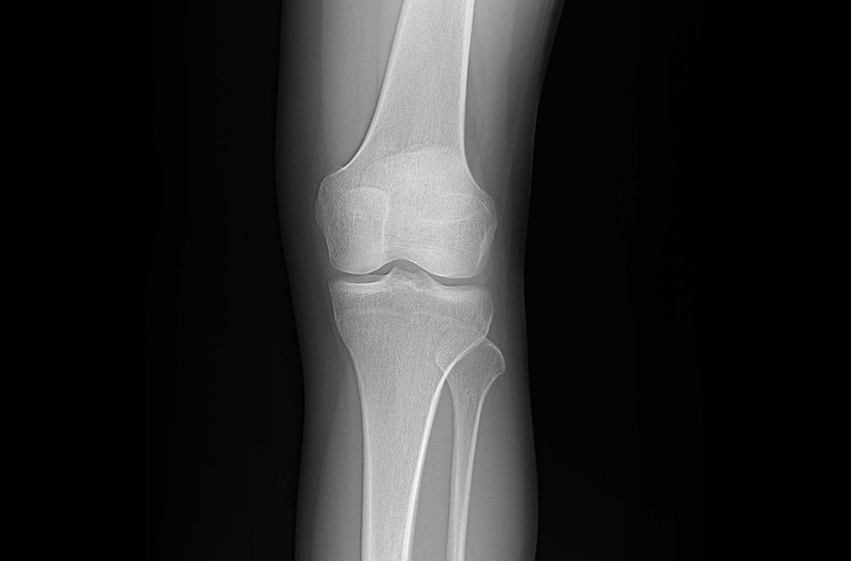 high resolution and clear diagnostic imaging results from using LG DXD