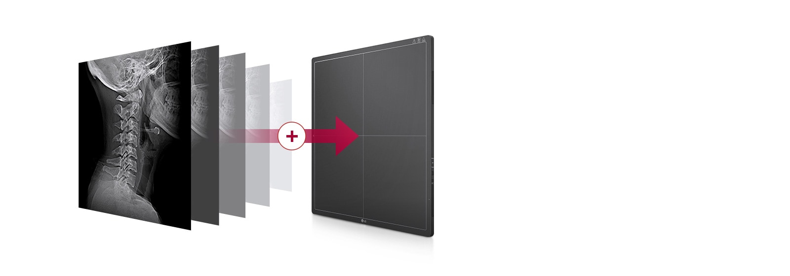 A built-in memory storage automatically storing the images taken on the detector up to 200 images