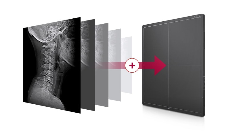 A built-in memory storage automatically storing the images taken on the detector up to 200 images