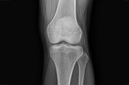 x-ray image 4.