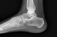 x-ray image 5.