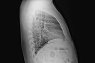 x-ray image 2.