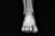 x-ray image 1.