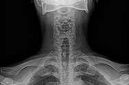 x-ray image 3.