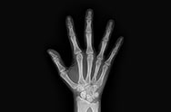 x-ray image 4.