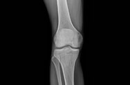 x-ray image 5.