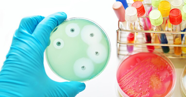 The image shows a hand in a blue glove holding a petri dish with a green agar plate with test tubes in the background.