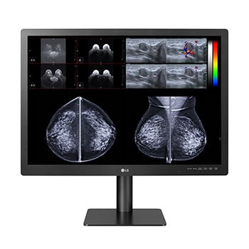  LG 31'' 12MP 4200 x 2800 IPS Diagnostic Monitor for Mammography1