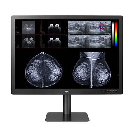 31-inch 12MP Diagnostic Monitor for Mammography2