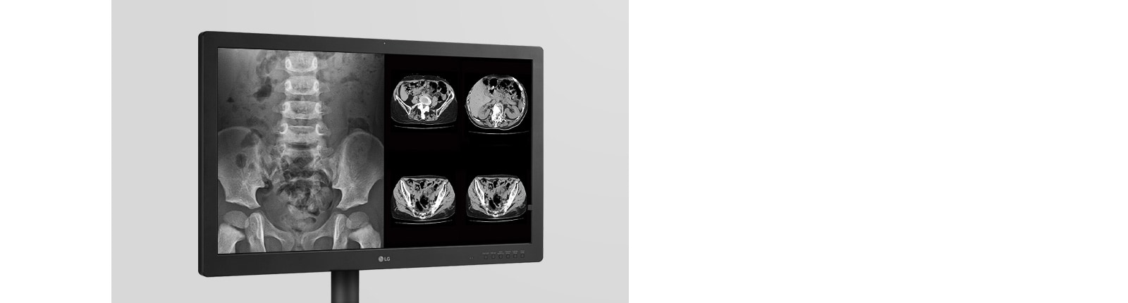 Reliable Imaging for Critical Assessment