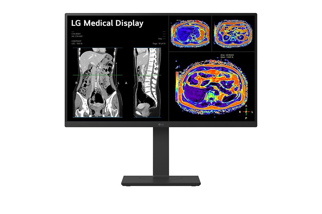 LG 27” 8MP IPS Clinical Review Monitor, front view, 27HS713C