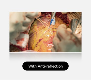 The right image, with anti-reflection coating, offers a clearer view with reduced glare.	