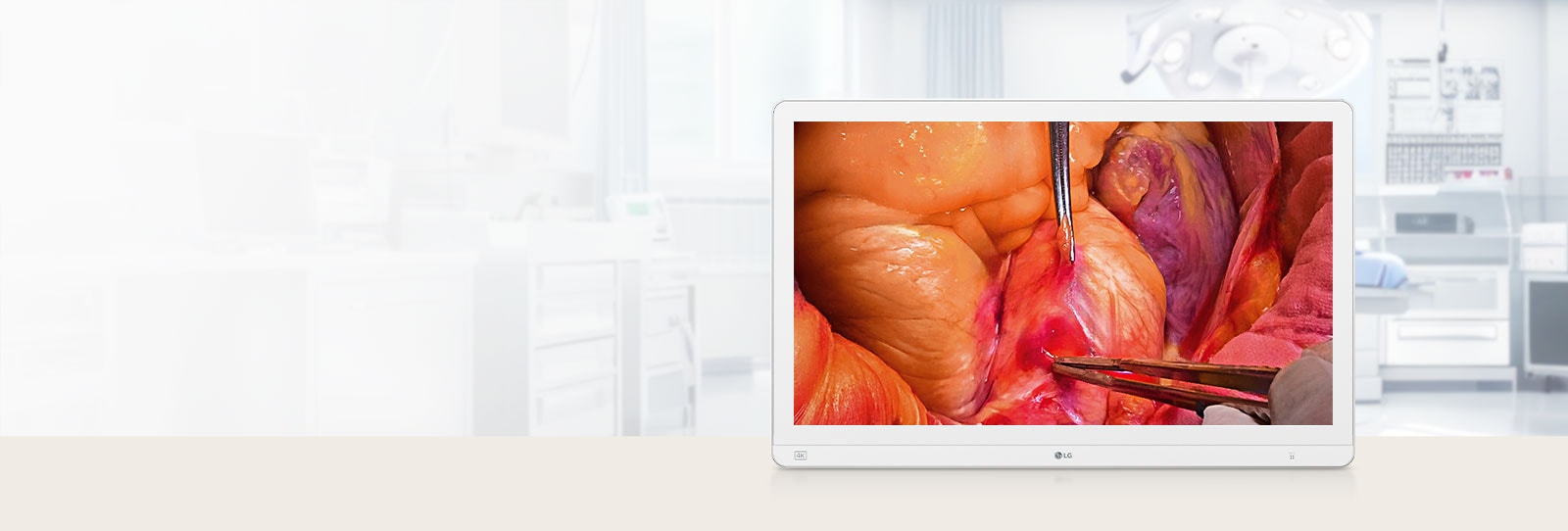 27-inch 4K Mini-LED surgical monitor displaying a high-resolution surgical image, set in a modern operating room environment.