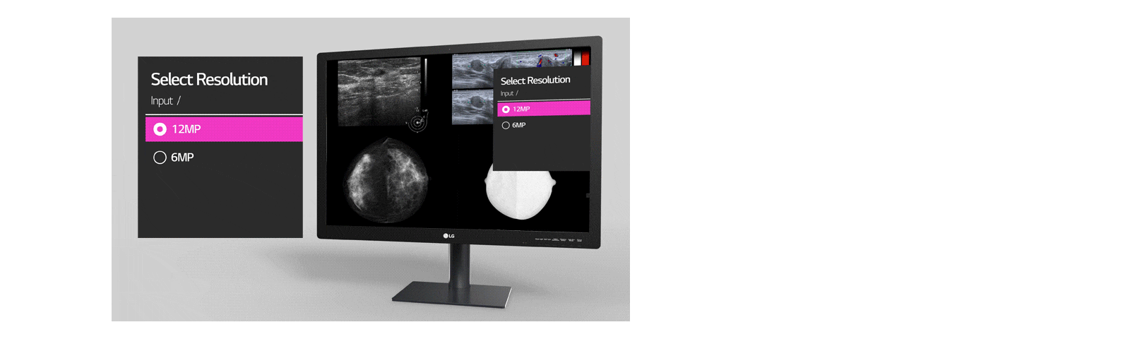 multi-resolution mode offering for users to select resolution between input of 12mp and of 6mp