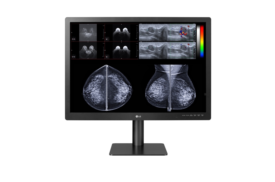 LG  LG 31'' 12MP 4200 x 2800 IPS Diagnostic Monitor for Mammography, front view with mammography imaging results on the screen , 31HN713D