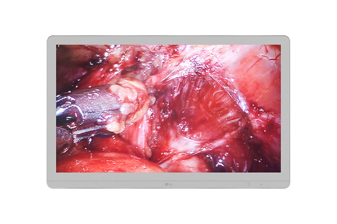 LG  LG 27'' 4K UHD IPS Surgical Monitor, Front view, 27HJ713S, thumbnail 2