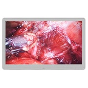 LG  LG 27'' 4K UHD IPS Surgical Monitor, Front view, 27HJ713S, thumbnail 2