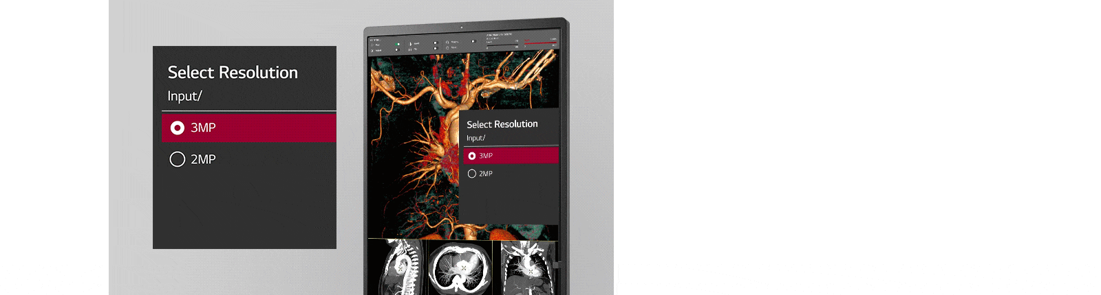 multi-resolution mode offering for users to select resolution between input of 3mp and of 2mp.