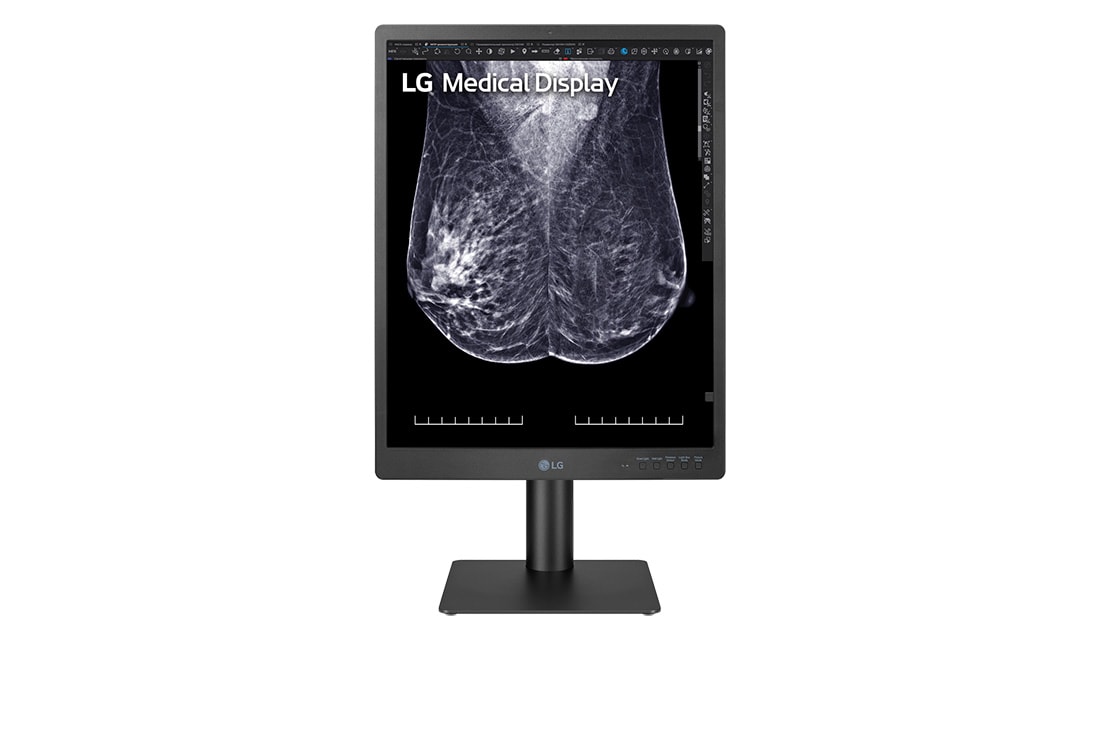 LG 21.3-inch 5MP IPS Diagnostic Monitor for Mammography, front view, 21HQ613D