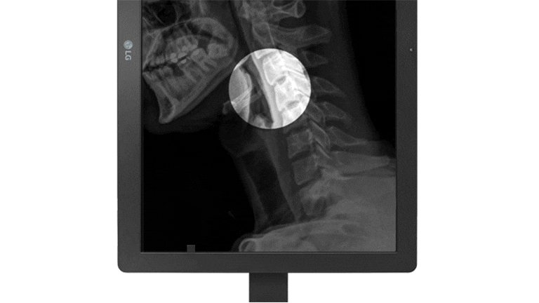 24HR513C features the Focus View Mode which highlights specific parts of the medical image. Users can easily select and focus on areas of concern while darkening the rest of the screen.	