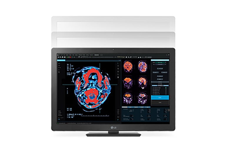 健康・医学 PCR/RT-PCRinsituLight&ElectronMicroscopy EZ-SARS-CoV-2 Real-Time RT-PCR Test - Tetracore, Inc.