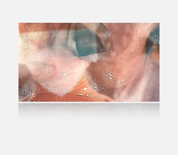 The left image shows a display without anti-glare, where reflections and glare obscure the view.	