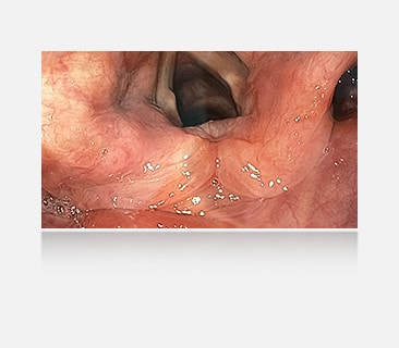 The right image, with anti-glare coating, provides a clear and unobstructed view, demonstrating the effectiveness of the coating.	