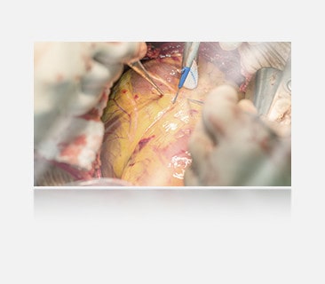 The left image shows a display without anti-reflection, with more glare and reflections affecting visibility. 	