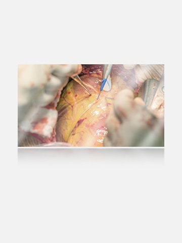 The left image shows a display without anti-reflection, with more glare and reflections affecting visibility. 	