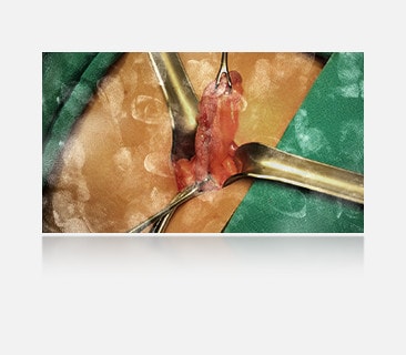 The left image shows a display with visible fingerprints and smudges, obstructing the view. 	