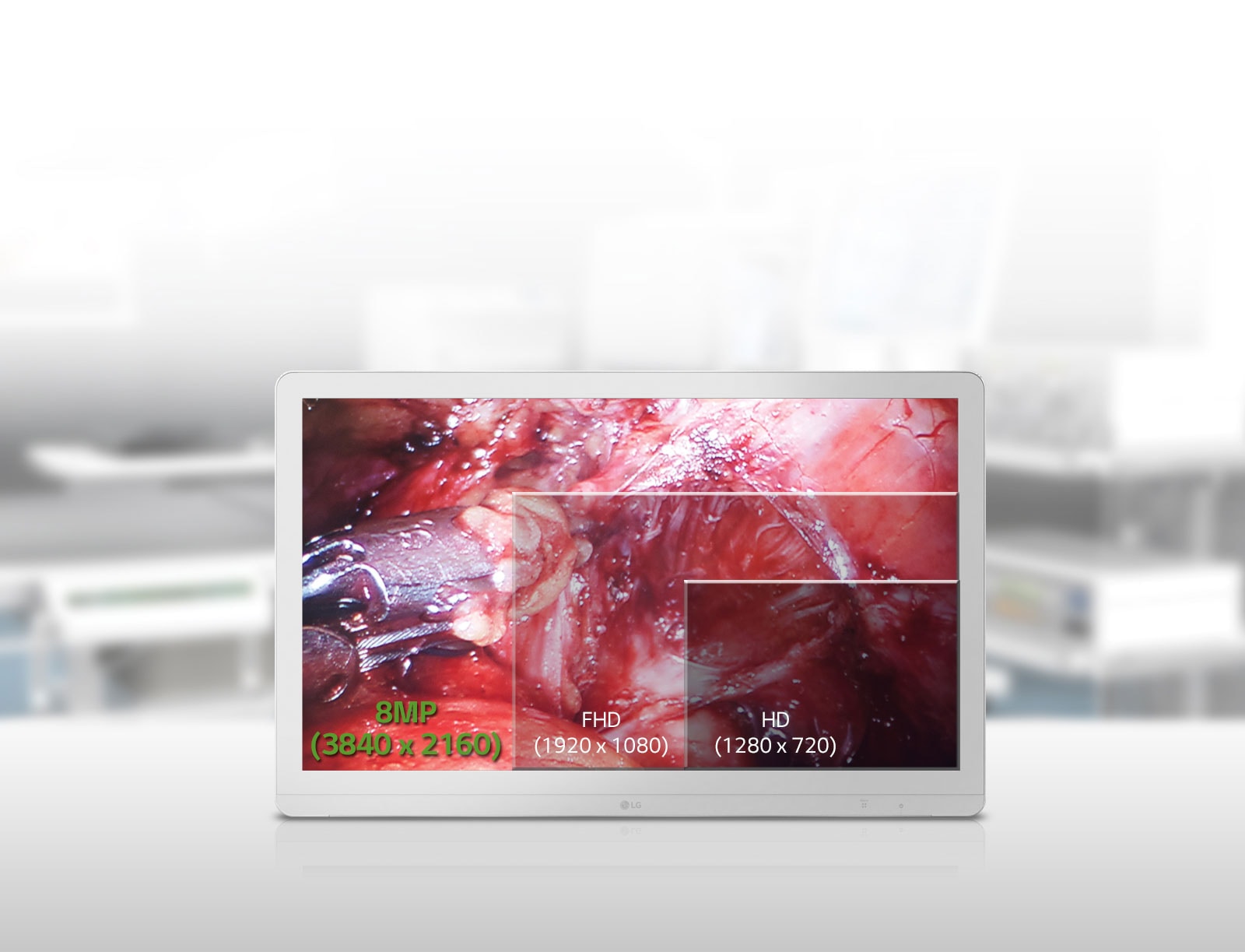 27 IPS 8MP Premium UHD<br>1