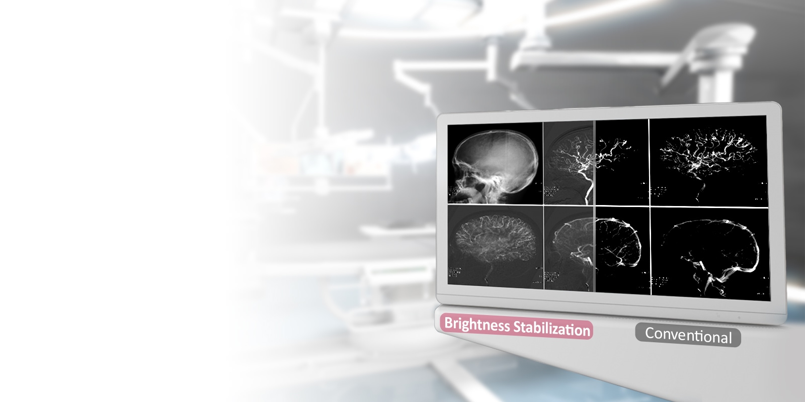 DICOM Part 14 και σταθεροποίηση φωτεινότητας <br>1