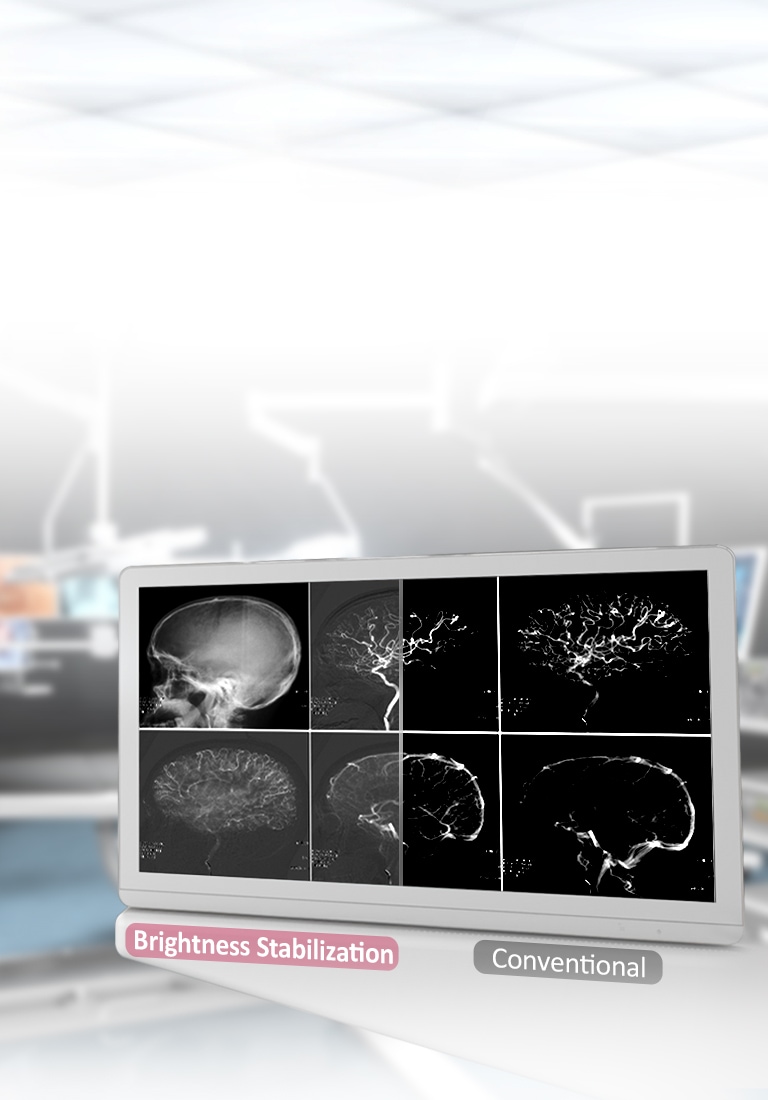 DICOM Part 14 και σταθεροποίηση φωτεινότητας <br>2