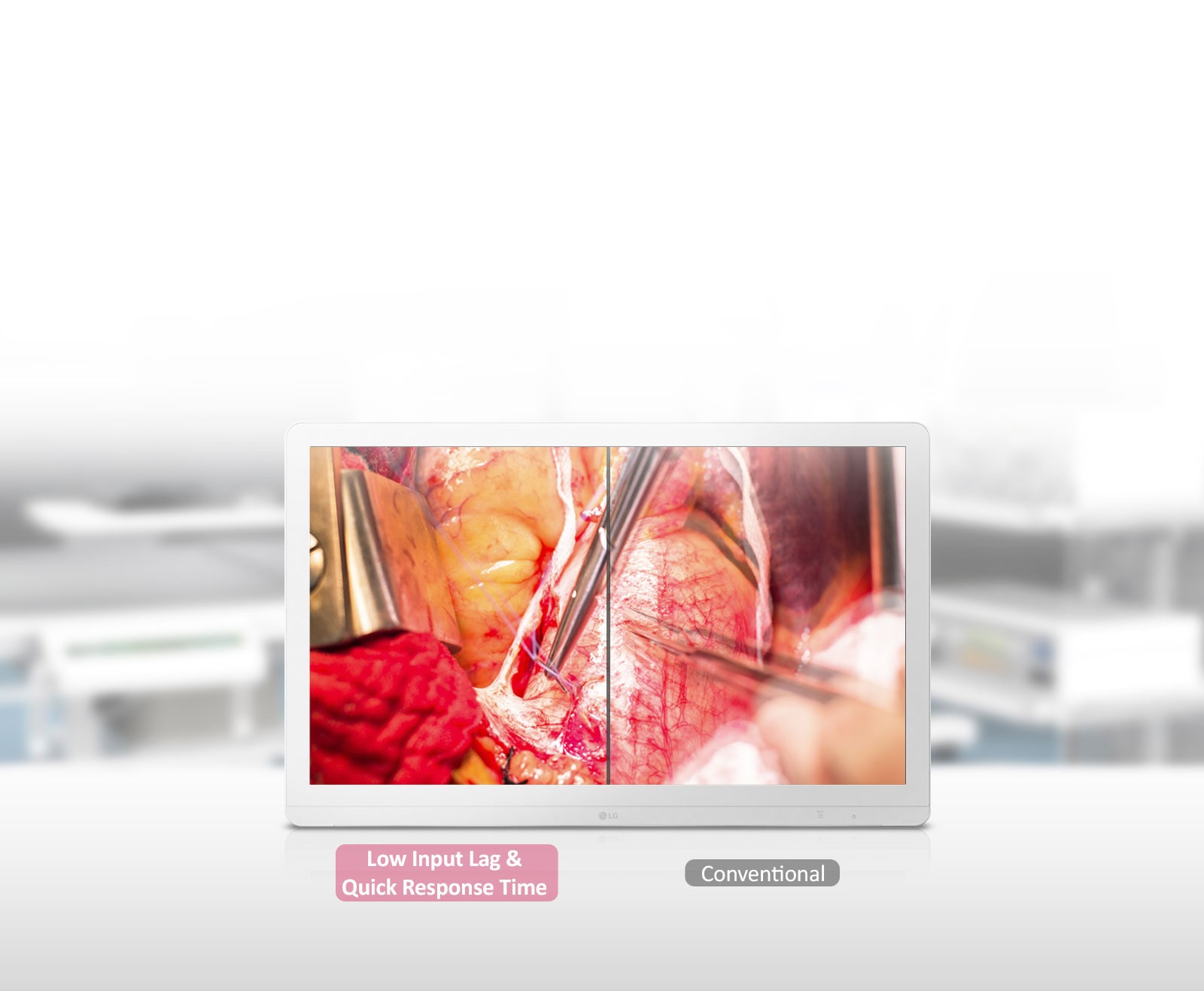 Dynamic Sync Mode& γρήγορος χρόνος απόκρισης<br>1