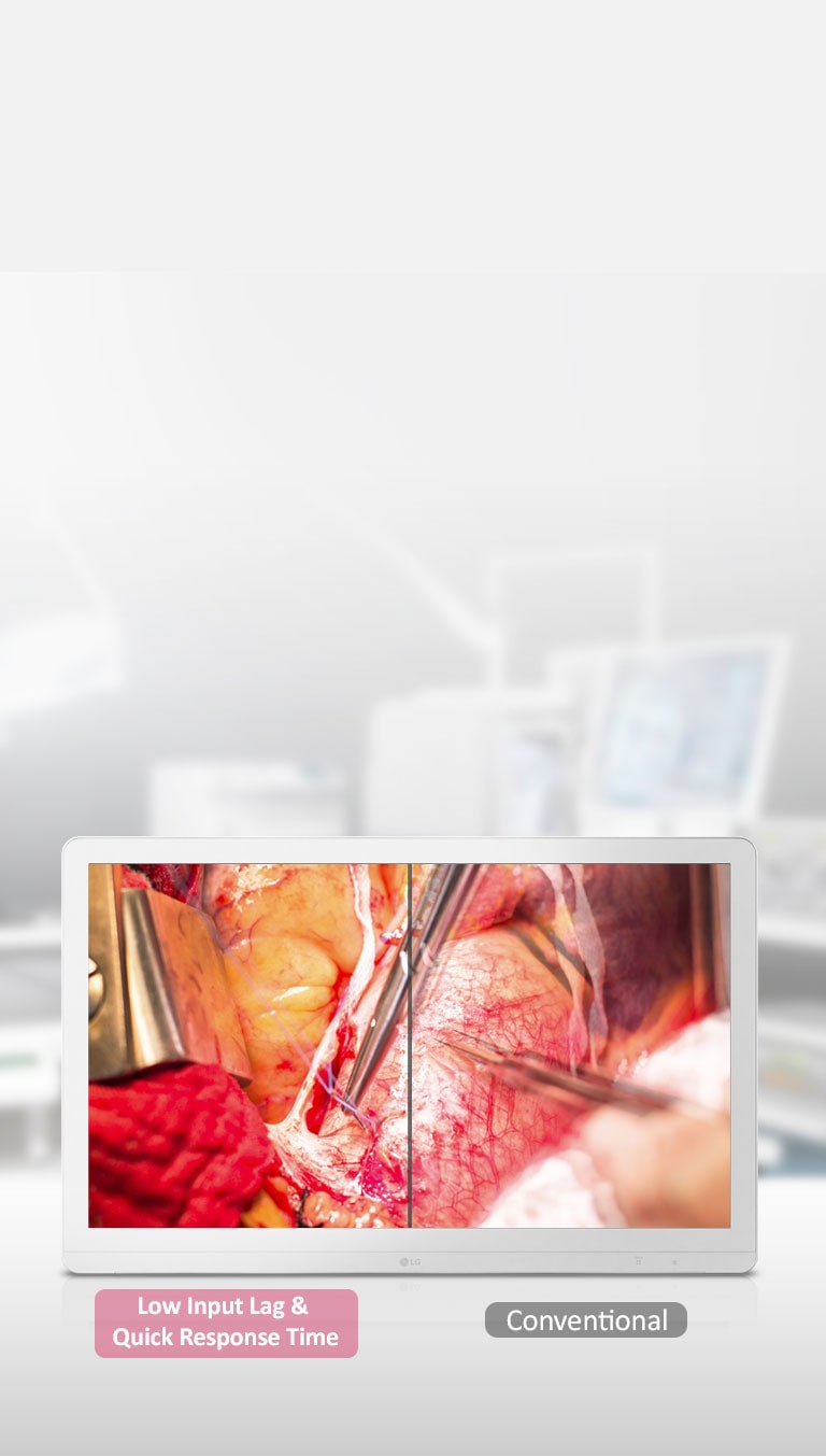 Dynamic Sync Mode& γρήγορος χρόνος απόκρισης<br>2