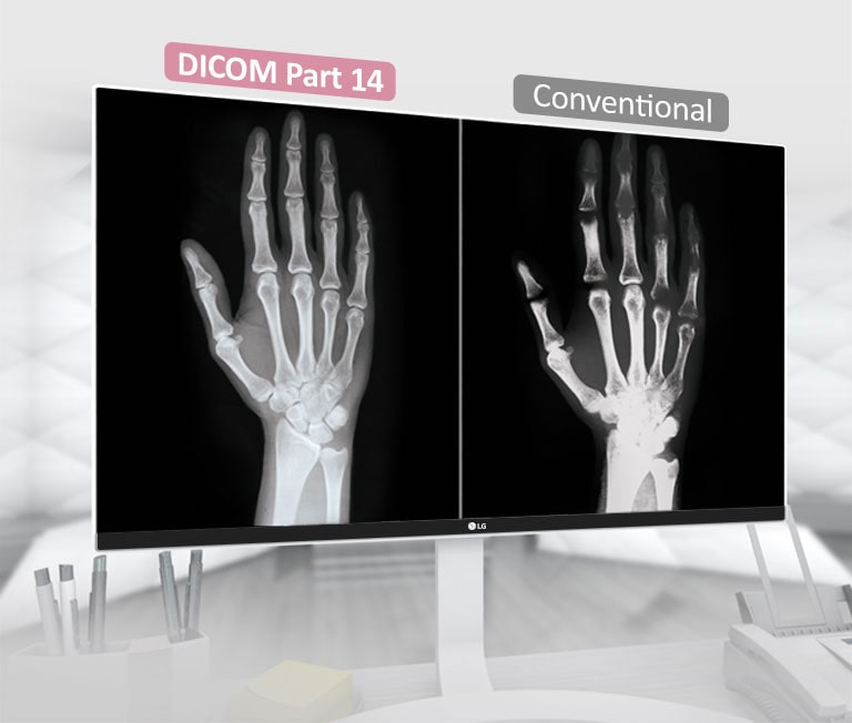 Πρότυπο DICOM Part 142