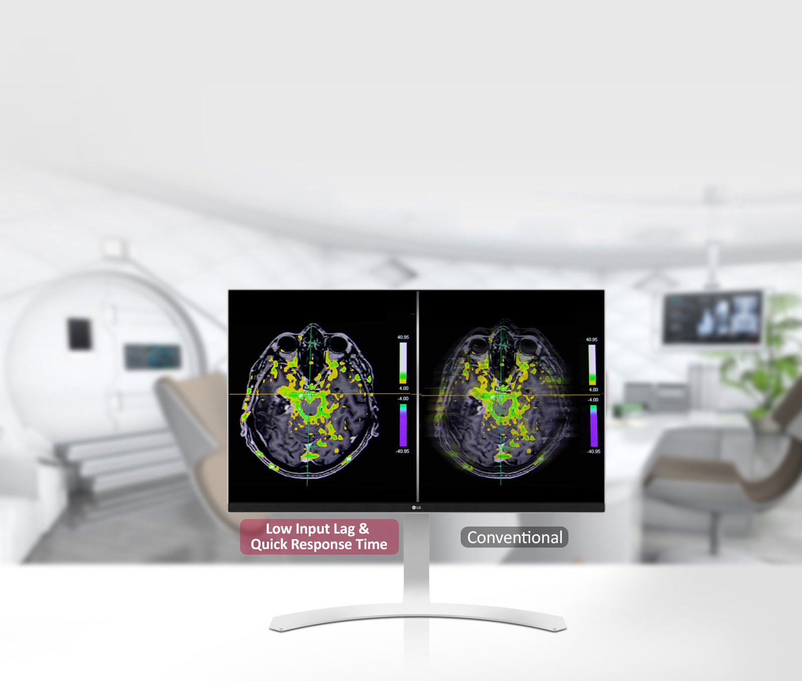 Dynamic Sync Mode και γρήγορος χρόνος απόκρισης 1