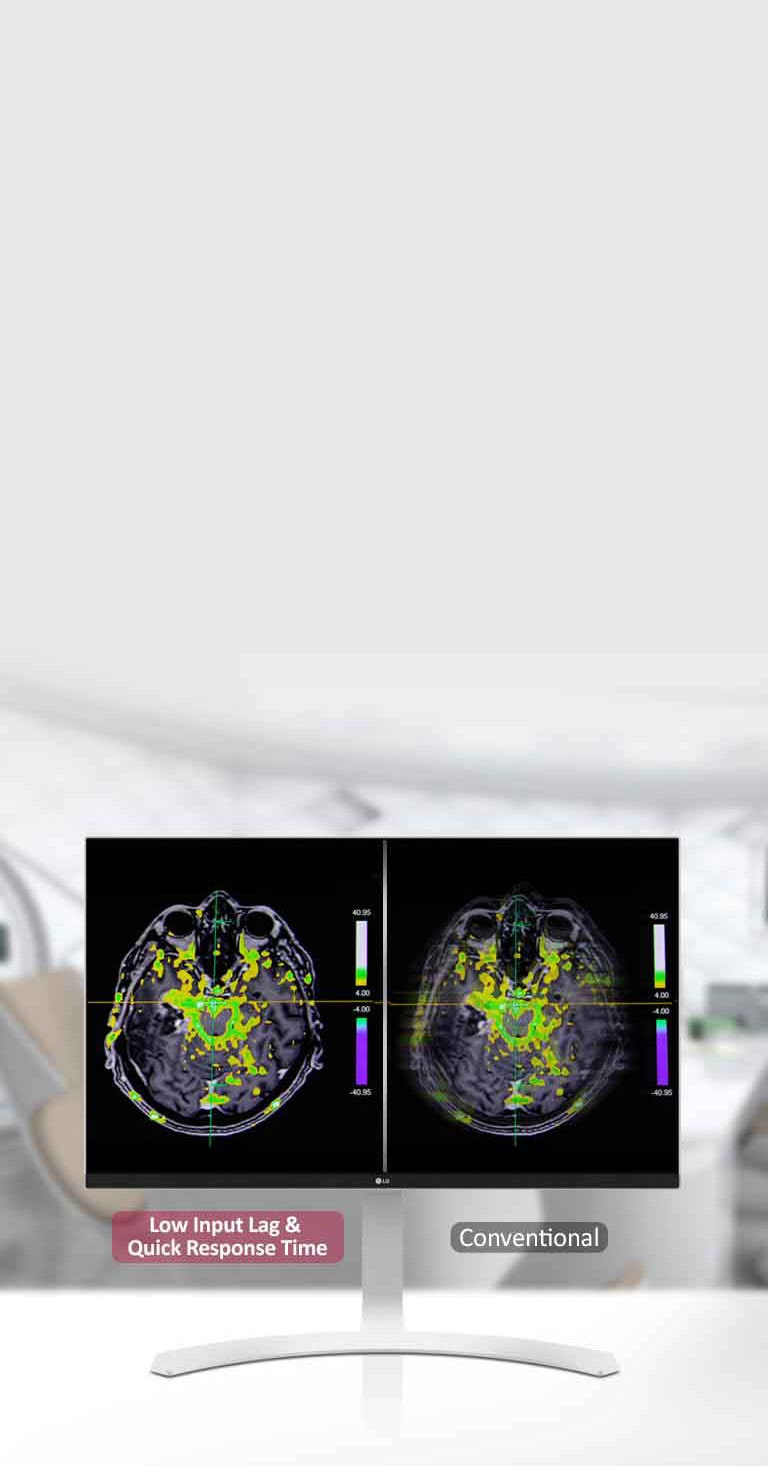 Dynamic Sync Mode και γρήγορος χρόνος απόκρισης 2