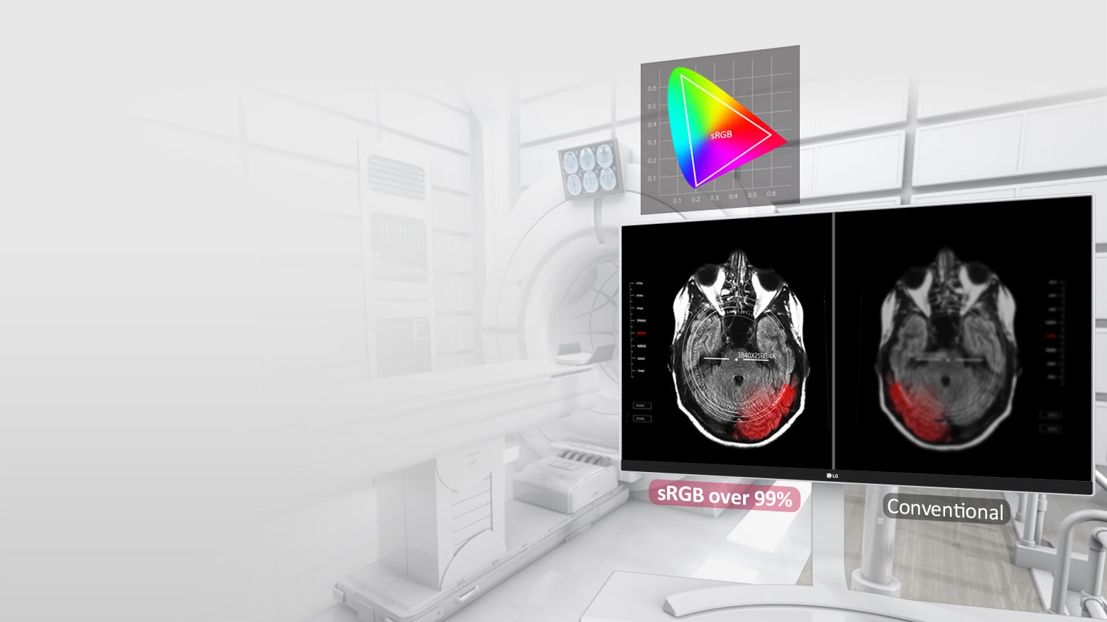 350 nits με sRGB άνω του 99%1