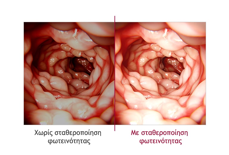 Σταθεροποίηση φωτεινότητας