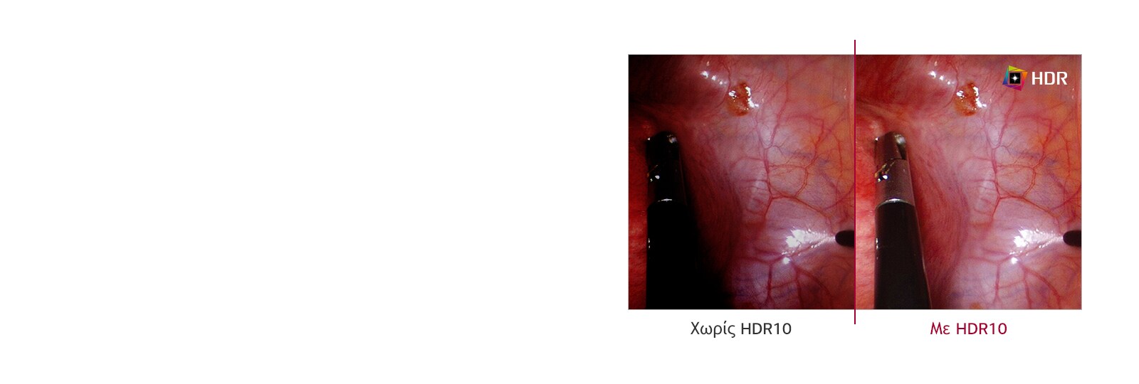 Υποστήριξη HDR10