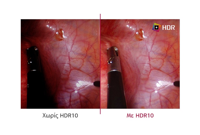 Υποστήριξη HDR10