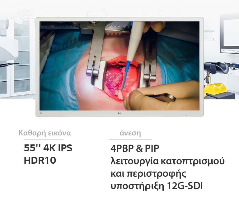 Η χειρουργική οθόνη 4K IPS 55MH5K 55 ιντσών της LG θα απογειώσει την ποιότητα εικόνας και την άνεσή σας.