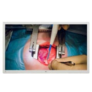 LG Χειρουργική οθόνη 55'' 4K IPS της LG, Μπροστινή όψη με εικόνα που γεμίζει το χώρο, 55MH5K-W, thumbnail 1
