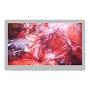 LG Μόνιτορ 27” Εφαρμογών Κλινικής Αξιολόγησης 8MP IPS & sRGB άνω του 99%, LG Οθόνες 27HJ710S-W 2, 27HJ710S-W, thumbnail 2