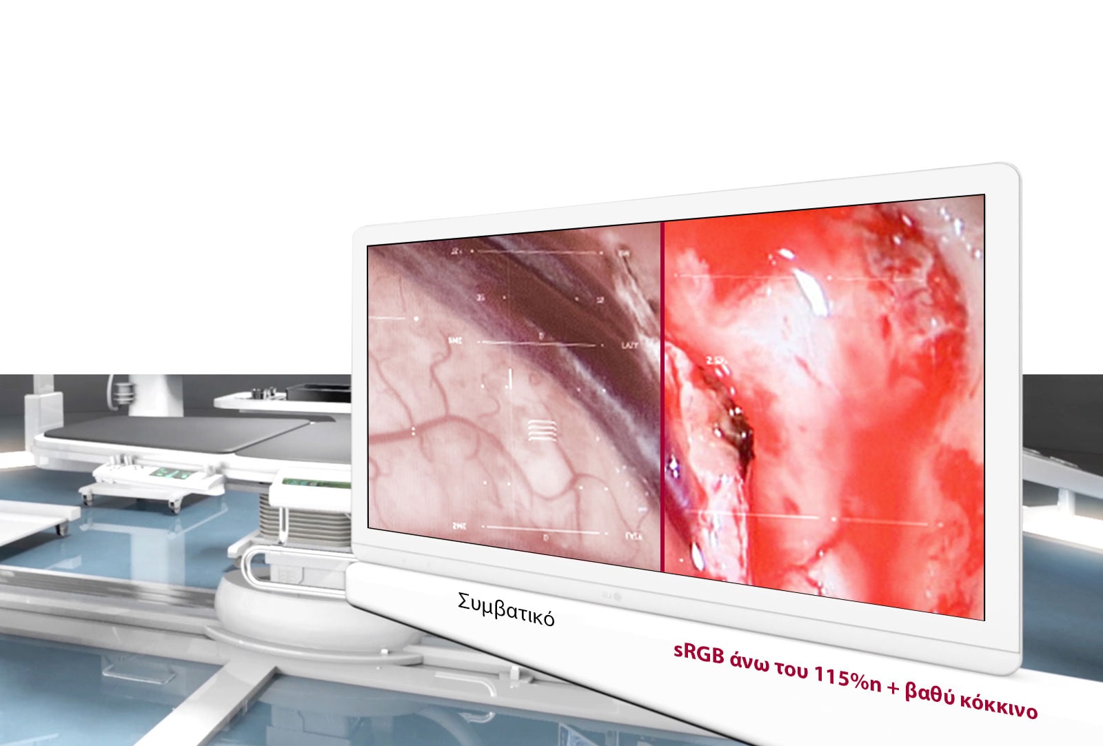 Βέλτιστη ποιότητα εικόνας