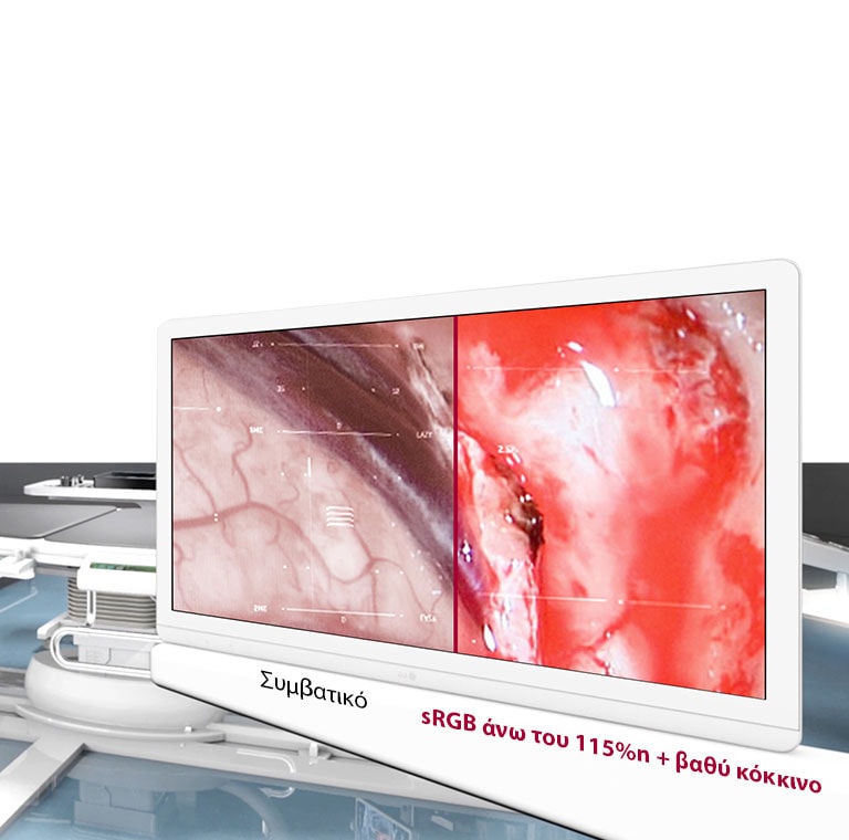 Βέλτιστη ποιότητα εικόνας