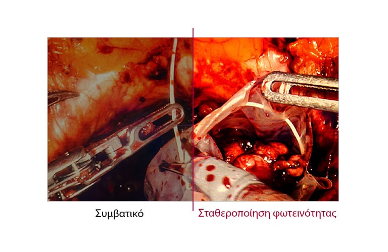 Σταθεροποίηση φωτεινότητας2