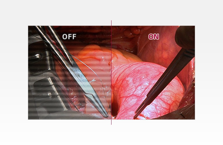 Μειώνει την καταπόνηση των ματιών